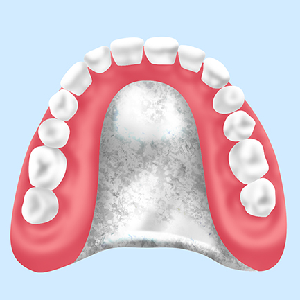 自費診療の入れ歯